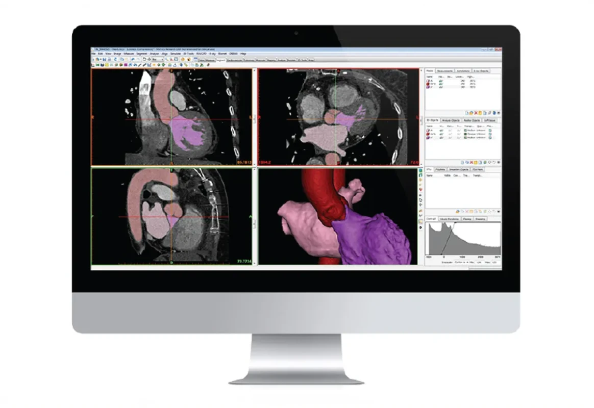 Materialise : Software for 3D printer
