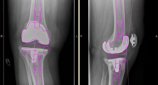 3D Printing in Medical Profession